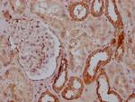 PKM Antibody in Immunohistochemistry (Paraffin) (IHC (P))