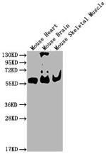 PKM Antibody in Western Blot (WB)