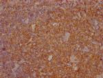 PKM Antibody in Immunohistochemistry (Paraffin) (IHC (P))