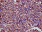 PKM Antibody in Immunohistochemistry (Paraffin) (IHC (P))