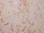 PKM Antibody in Immunohistochemistry (Paraffin) (IHC (P))