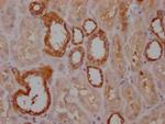 PKM Antibody in Immunohistochemistry (Paraffin) (IHC (P))