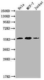 PKM Antibody in Western Blot (WB)