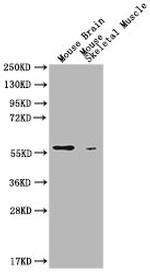 PKM Antibody in Western Blot (WB)