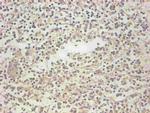 NGAL Antibody in Immunohistochemistry (Paraffin) (IHC (P))