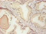 NGAL Antibody in Immunohistochemistry (Paraffin) (IHC (P))