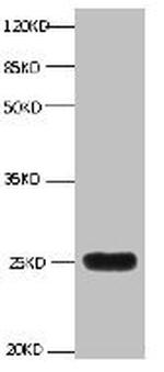 NGAL Antibody in Western Blot (WB)