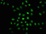 Phospho-PKR (Thr446) Antibody in Immunocytochemistry (ICC/IF)