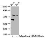 Phospho-PKR (Thr446) Antibody in Western Blot (WB)