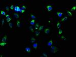 ITGB1 Antibody in Immunocytochemistry (ICC/IF)