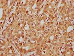 ITGB1 Antibody in Immunohistochemistry (Paraffin) (IHC (P))