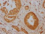 Cdc42 Antibody in Immunohistochemistry (Paraffin) (IHC (P))