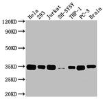 ATF5 Antibody in Western Blot (WB)