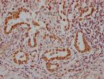 Nkx2.1 Antibody in Immunohistochemistry (Paraffin) (IHC (P))