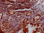 KLF4 Antibody in Immunohistochemistry (Paraffin) (IHC (P))