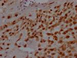 GATA3 Antibody in Immunohistochemistry (Paraffin) (IHC (P))