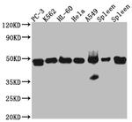 Arp3 Antibody in Western Blot (WB)