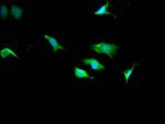 TPT1 Antibody in Immunocytochemistry (ICC/IF)