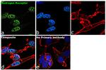 Androgen Receptor Antibody in Immunocytochemistry (ICC/IF)