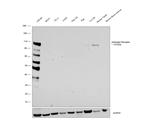 Androgen Receptor Antibody