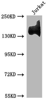 ITGA4 Antibody in Western Blot (WB)