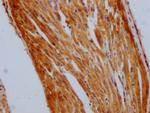 STAT3 Antibody in Immunohistochemistry (Paraffin) (IHC (P))