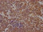 STAT3 Antibody in Immunohistochemistry (Paraffin) (IHC (P))