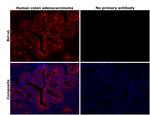 Bcl-xL Antibody in Immunohistochemistry (Paraffin) (IHC (P))