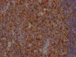 FAS Antibody in Immunohistochemistry (Paraffin) (IHC (P))