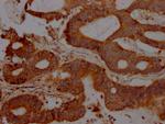 FAS Antibody in Immunohistochemistry (Paraffin) (IHC (P))