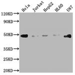 FAS Antibody in Western Blot (WB)