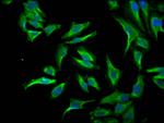 ID1 Antibody in Immunocytochemistry (ICC/IF)