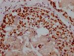 Ku80 Antibody in Immunohistochemistry (Paraffin) (IHC (P))