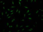 PAK1 Antibody in Immunocytochemistry (ICC/IF)