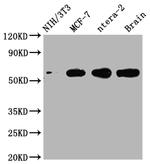 PAK1 Antibody in Western Blot (WB)