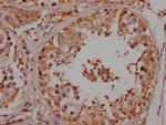 NGF Antibody in Immunohistochemistry (Paraffin) (IHC (P))