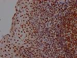 HMGB1 Antibody in Immunohistochemistry (Paraffin) (IHC (P))