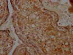 CD266 Antibody in Immunohistochemistry (Paraffin) (IHC (P))