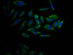 CYP17A1 Antibody in Immunocytochemistry (ICC/IF)