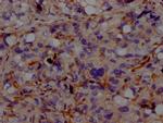 ACVRL1 Antibody in Immunohistochemistry (Paraffin) (IHC (P))