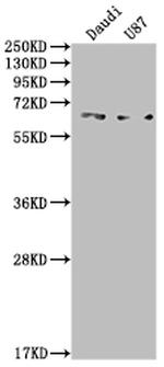 ACVRL1 Antibody in Western Blot (WB)