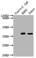 CDK6 Antibody in Immunoprecipitation (IP)