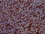 PABPN1 Antibody in Immunohistochemistry (Paraffin) (IHC (P))