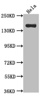 XDH Antibody in Western Blot (WB)