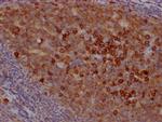 CD38 Antibody in Immunohistochemistry (Paraffin) (IHC (P))