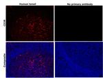 CD38 Antibody in Immunohistochemistry (Paraffin) (IHC (P))