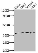 TBP Antibody in Western Blot (WB)