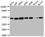 NUDC Antibody in Western Blot (WB)