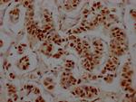 RbAp48 Antibody in Immunohistochemistry (Paraffin) (IHC (P))