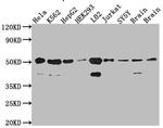 RbAp48 Antibody in Western Blot (WB)